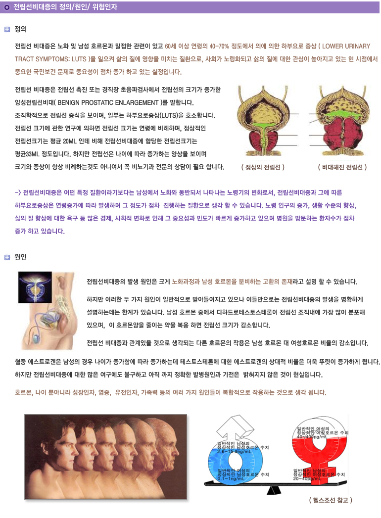 전립선비대증의 정의/원인/위험인자