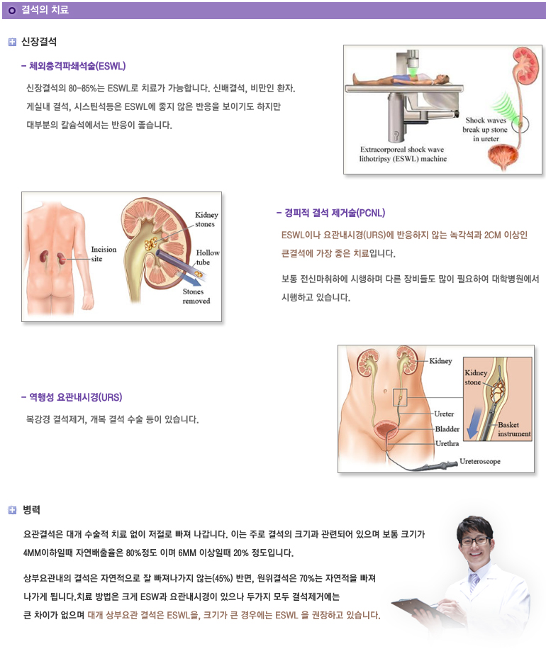 결석의 치료